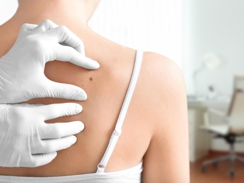 Kožní ordinace Medicentrum Beroun - MUDr. Ivica Přibylová